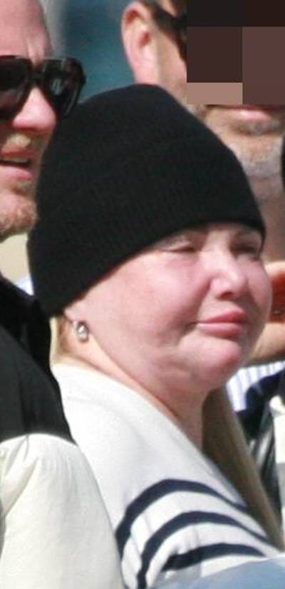 Katarzyna Niezgoda z odmienioną twarzą wypoczywa w Sopocie z mężem i przyjaciółmi. Zobacz następne zdjęcie