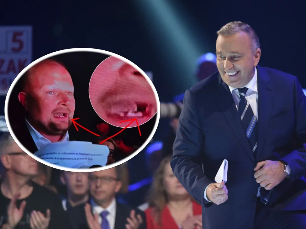 Schetyna ze złotą radą: Zęby to wizytówka. Zembaczyński  z niej skorzysta?