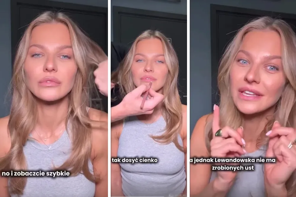 Lewandowska znów tłumaczy się z ust! „Bez strzykawki!” – zapewnia