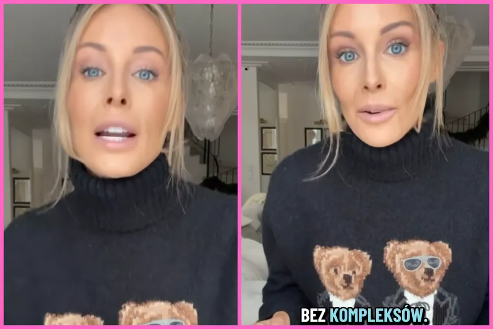 Perfekcyjna twarz Małgorzaty Rozenek namawia do udziału w programie „Bez kompleksów”. Ktoś chętny?