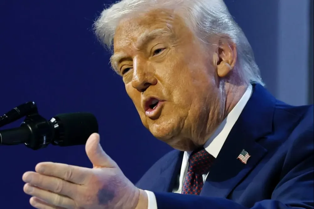 Co się dzieje z rękami Trumpa?  Odpowiedź zaskakuje