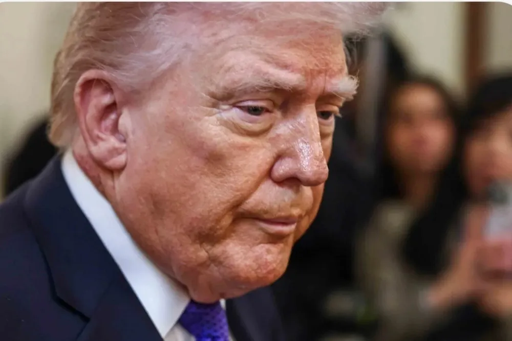 79‑letni Donald Trump niepokoi Amerykanów. Czerwona plama na szyi, siniaki na dłoniach i nagrania, na których przysypia