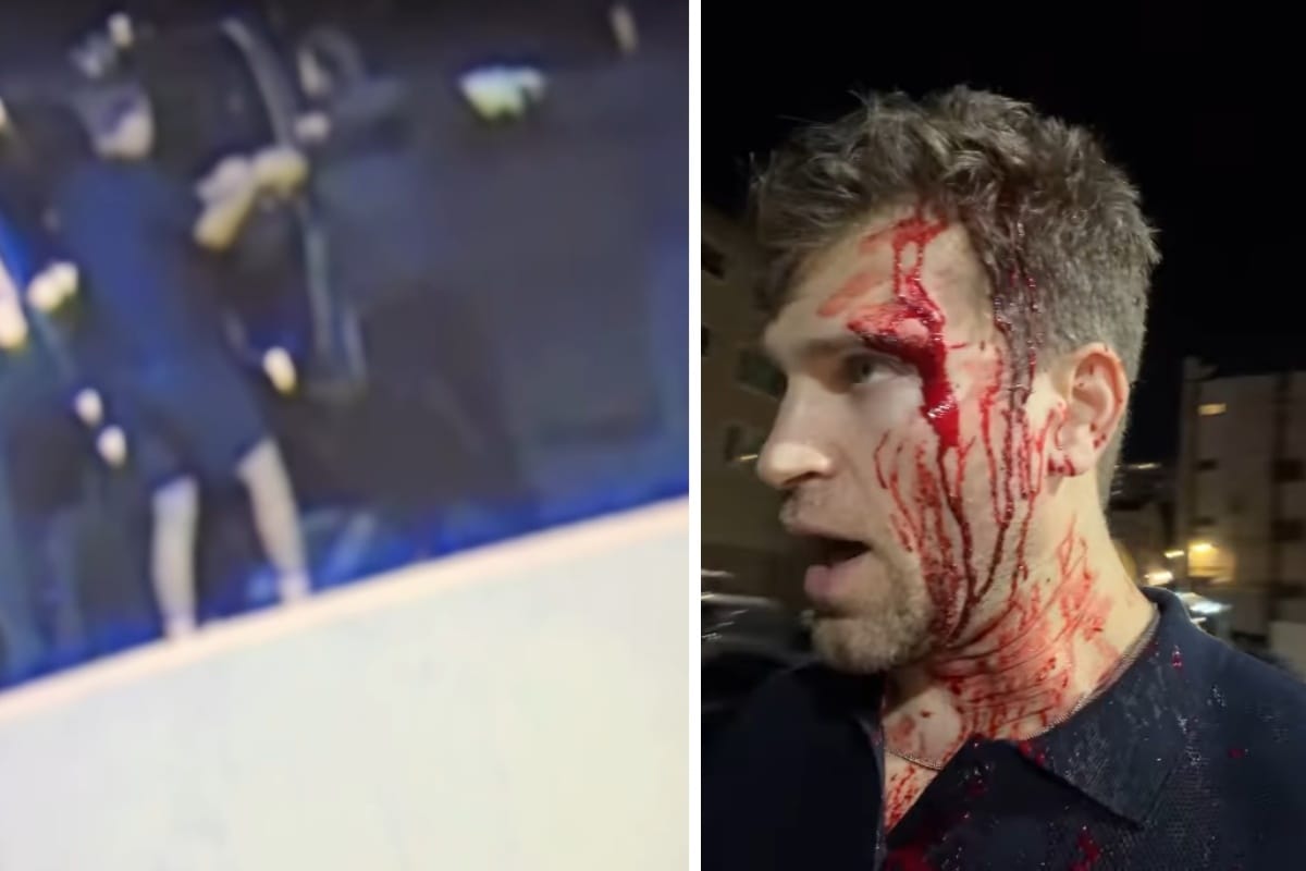 Krew na twarzy gwiazdora. Brutalny napad w Hollywood. „Mogli mnie zabić” [WIDEO]