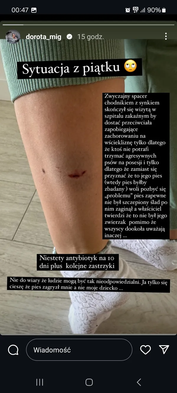 Dorota została pogryziona przez psa