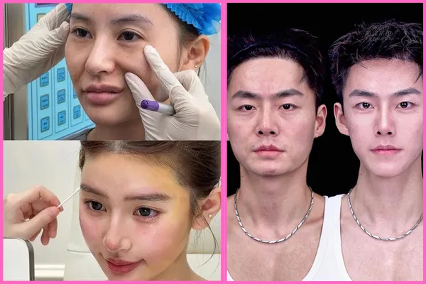 Trójkątna twarz i oczy jak z kreskówki. Młodzi Azjaci operują się na potęgę [ZDJĘCIA]