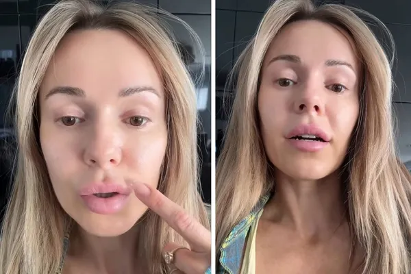 Koniec z wielkimi ustami! Doda pozbywa się kwasu i chwali nowym, naturalnym wyglądem